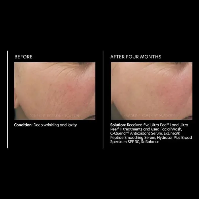 C-Quench® Antioxidant Serum | PCA Skin